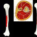 Frattura dell'omero: osteosintesi con placca mediale, da via d'accesso laterale